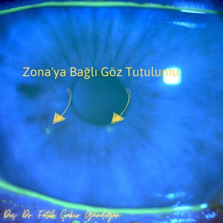 Gözlerden Seçmeler
